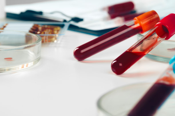 医学实验室中放置在桌子上的试管的特写图片下载