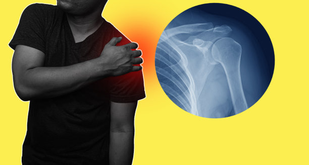 肩关节和锁骨骨折疼痛的男子，青年男子抱着自己的肩关节疼痛的症状是肩关节炎症的医疗保健概念。图片下载