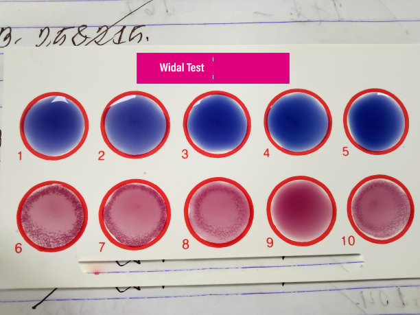 伤寒、副伤寒肥达试验板。图片下载