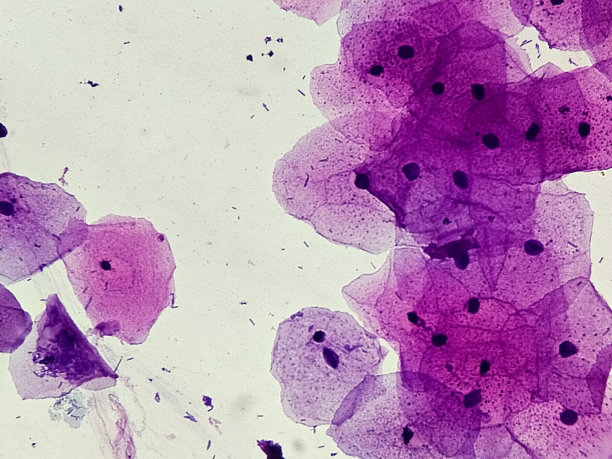 口腔涂片显示口腔黏膜脱落的鳞状细胞。主要位于右侧细胞的蓝色小点是细菌。光显微照片。图片下载