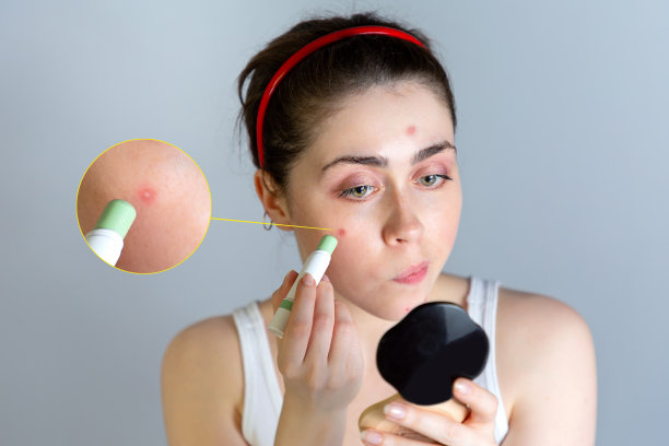 一个漂亮的年轻女人对着一面小巧的镜子，用一支遮瑕笔遮住了脸上的痘痘。美容与青春痘控制的概念，青春期。放大图像图片下载