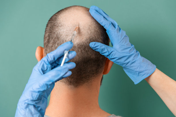 一名秃顶的男子正在接受毛发专家的中光疗法。后视图。青绿色的背景。脱发的概念与专业治疗图片下载