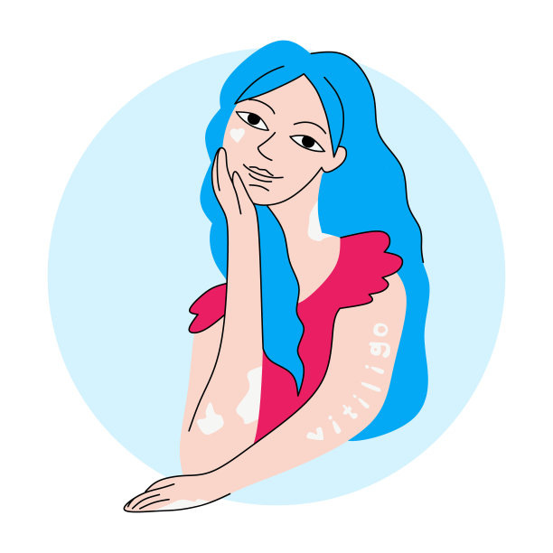 患有白癜风皮肤病的微笑女人图片下载