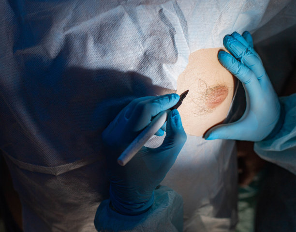 医生整形外科医生用注射器纠正男性乳房的脂肪组织。减少男性乳房脂肪，男性乳房肥大图片下载