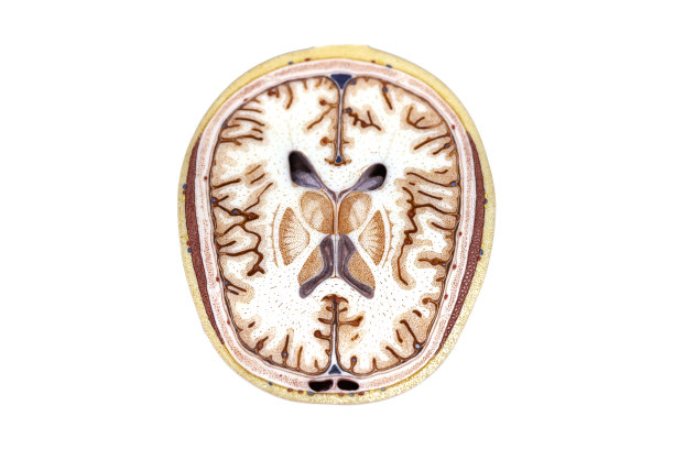 横断面通过人体头部模型板4从11板进行物理解剖教育。图片下载