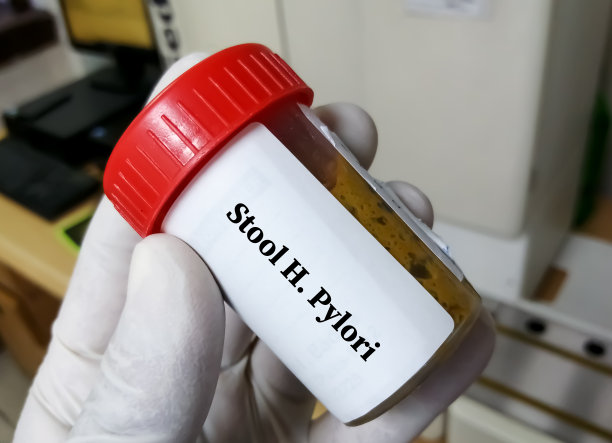 科学家手持装有粪便样本的容器进行幽门螺杆菌检测。消化性溃疡诊断。图片下载