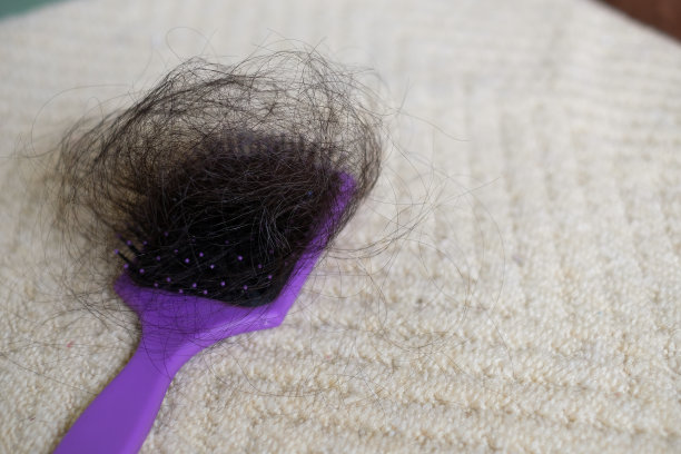 脱发问题图片下载