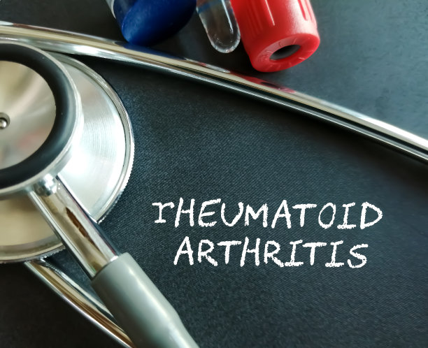 Rheumatiod关节炎。医学和健康概念。骨骼疾病。图片下载