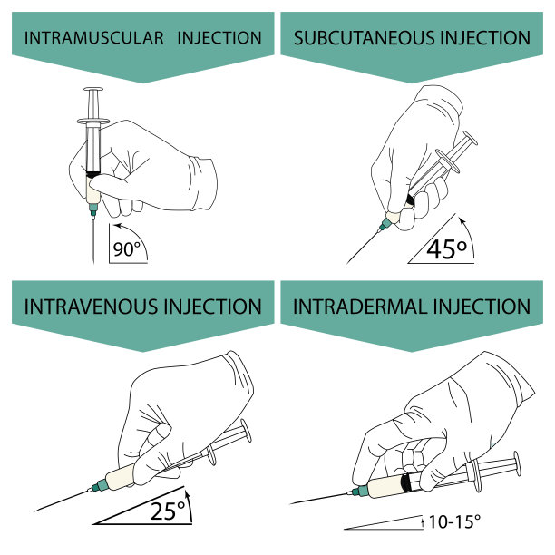 如何正确地进行注射。不同类型的注射信息图。戴着注射器的手。图片下载