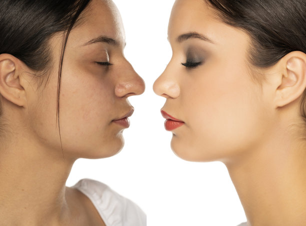 女性鼻子整形前后的比较图片下载