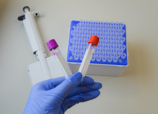 冠状病毒抗体检测呈阳性检查人群对covid - 19的免疫力。在实验室研究的背景下，医生手里拿着一根装有血液测试的试管图片下载