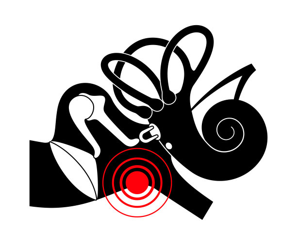 中耳炎疾病图片下载