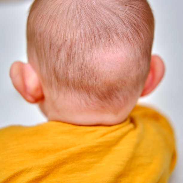 婴儿后脑勺上的秃斑。揉搓小孩的头发图片下载