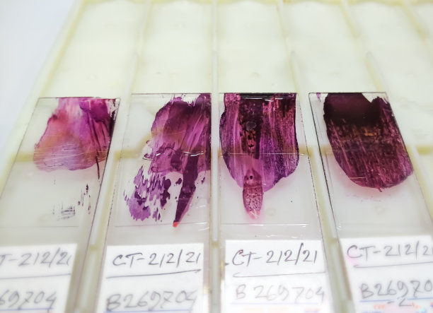 细胞学切片(Pap染色)近距离观察，切片选择性聚焦，可用于显微镜检查图片下载