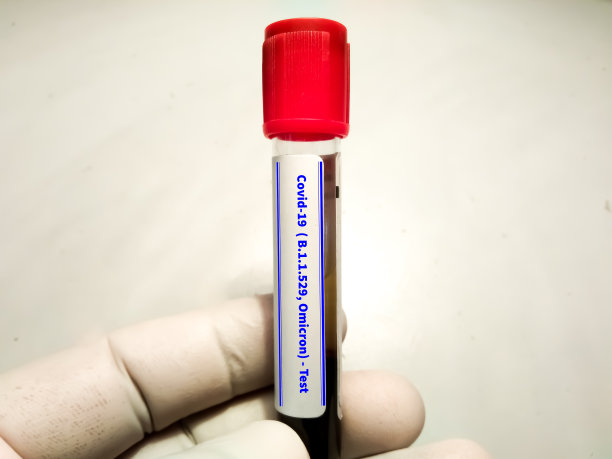 研究人员保留了Covid-19 Omicron B.1.1.529新变种的血液样本。图片下载