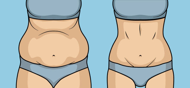 女性腹部减肥整形手术。腹部脂肪女孩腹肌减掉前后的脂肪团图片下载