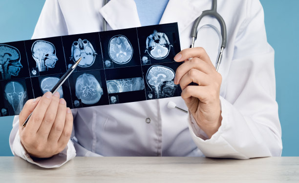 女医生用手指着x光医学影像在头上检查图片下载