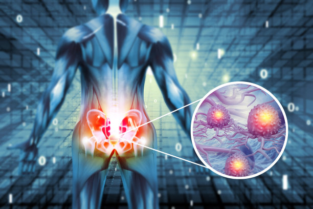 髋关节疼痛骨骼x光片。骨癌。三维演示图片下载