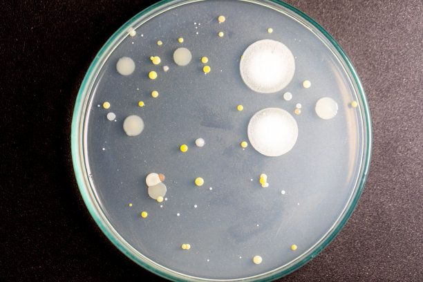 微生物实验室教育用土壤样品中细菌和霉菌在琼脂平板上生长的特点和不同形状菌落的背景。图片下载