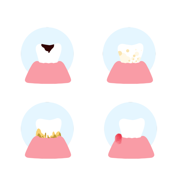 口腔问题图片下载