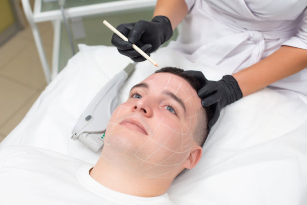 照片上，一个年轻英俊的男人躺在皮肤科办公室的沙发上，而戴着黑色医用手套的美容师的手拿着白色的化妆铅笔，在男人的脸上做着记号，准备进行面部激光脱毛手术图片下载