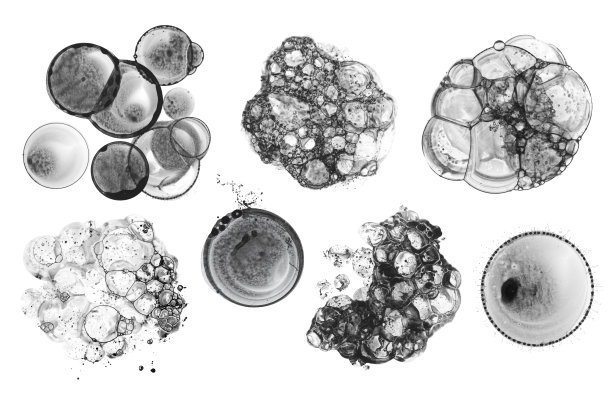 水彩泡沫肥皂泡沫印迹滴飞溅。摘要纹理黑色污点白色背景。集合,集合。图片下载
