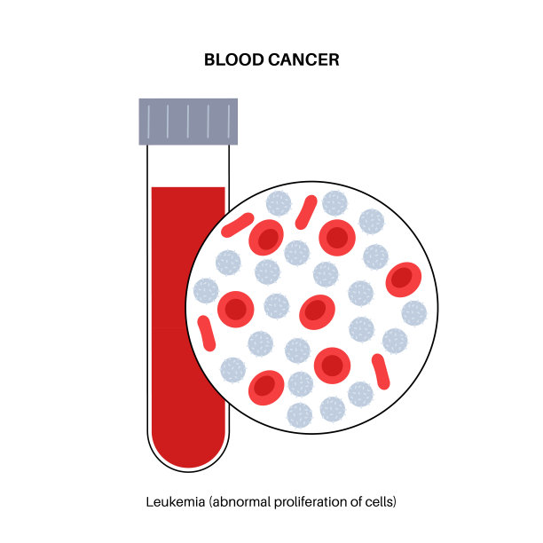 白血病癌症疾病图片下载