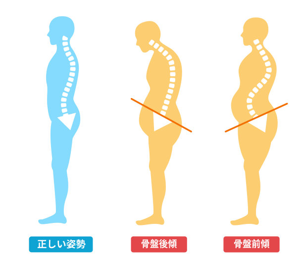 骨盆前后倾斜:正确的姿势和身体插图图片下载