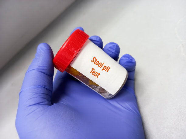 装有粪便的容器进行粪便pH值测试，它的酸度测试以诊断医疗状况，粪便pH值测试。图片下载