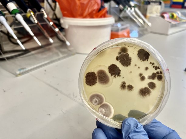 琼脂板被细菌真菌污染图片下载