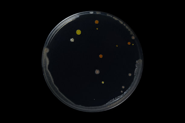 培养皿和培养基上的细菌在黑色背景上进行修剪，检测各种细菌、病毒、冠状病毒、冠状病毒、COVID-19、微生物数量。食品科学。图片下载