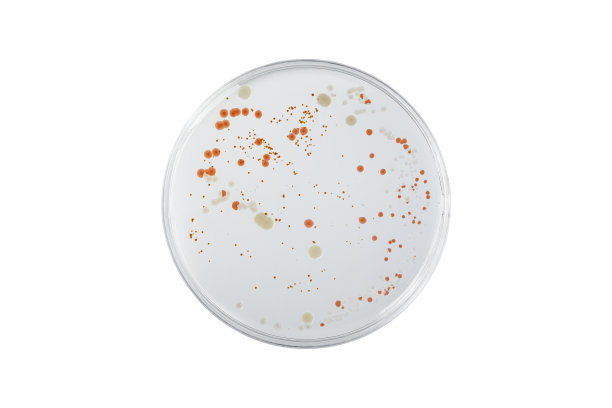 培养皿和培养基上的细菌在白色背景上剪开，检测各种细菌、病毒、冠状病毒、冠状病毒、COVID-19、微生物数量。食品科学。图片下载