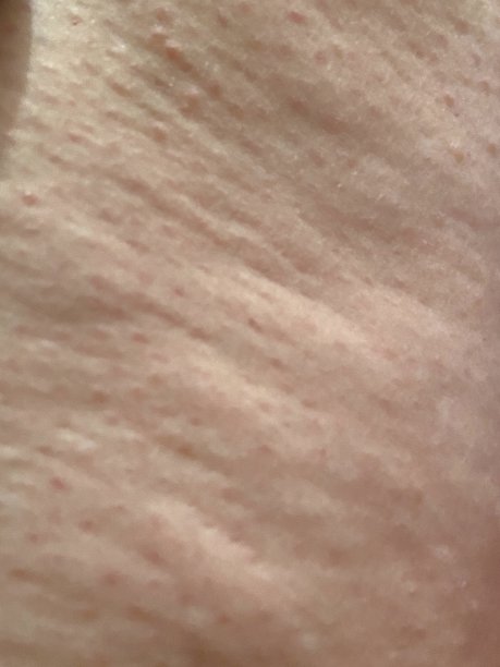 脂肪团纹理皮肤背景表面图片下载