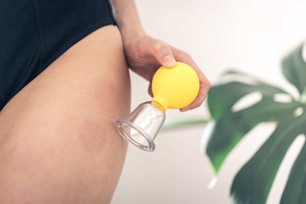 一个女人在她的臀部和臀部做真空减肥按摩。图片下载