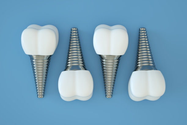 种植牙，人造牙，种植牙，蓝色背景图片下载