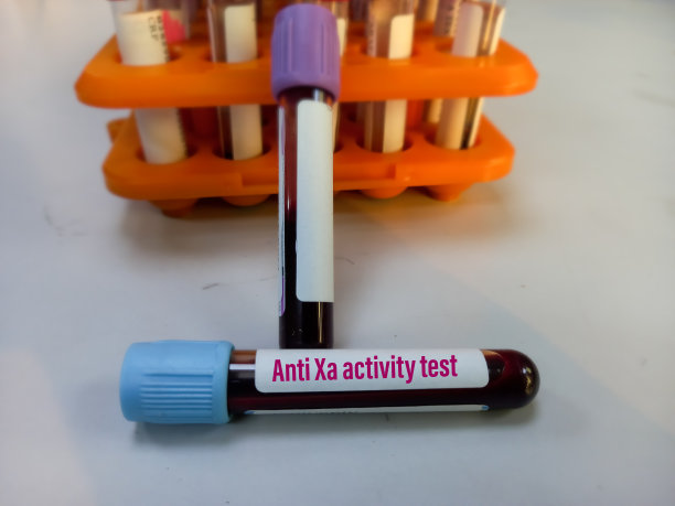 血液样本抗Xa活性试验。血管内凝血，凝血障碍图片下载