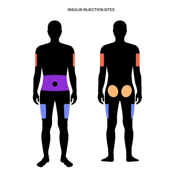 胰岛素注射部位图片下载