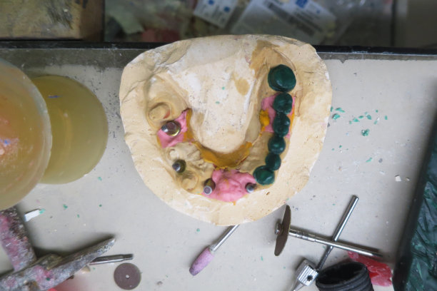 牙科化验所的牙齿指纹图片下载