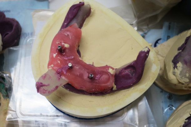 牙科化验所的牙齿指纹图片下载