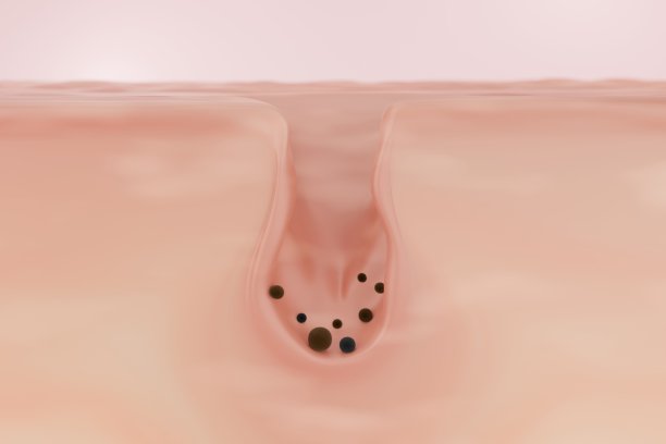 肮脏的孔隙图片下载