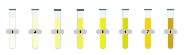 尿液颜色表。图片下载