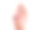 白色背景的女性手部有冻疮皮炎图片下载