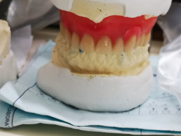 牙科护理和修复的牙印图片下载