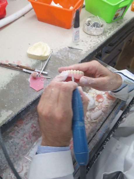 牙科化验所的牙齿指纹图片下载