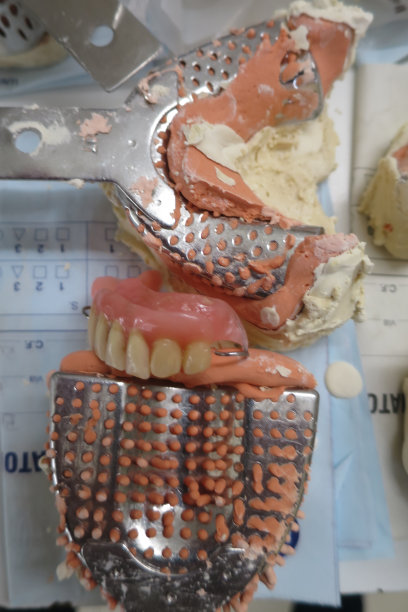 牙科化验所的牙齿指纹图片下载