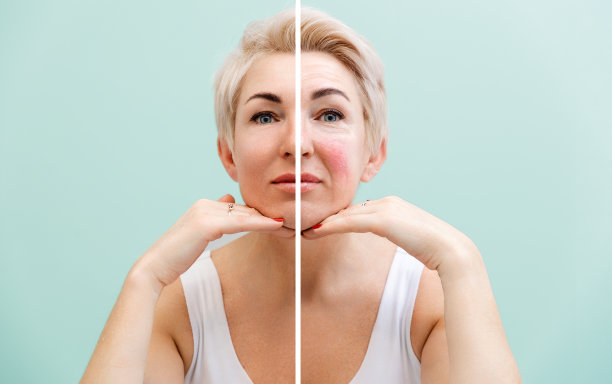专业的美容。一名成年白人妇女的面部变化后的肖像。面部分为两部分——治疗前和治疗后的效果图片下载