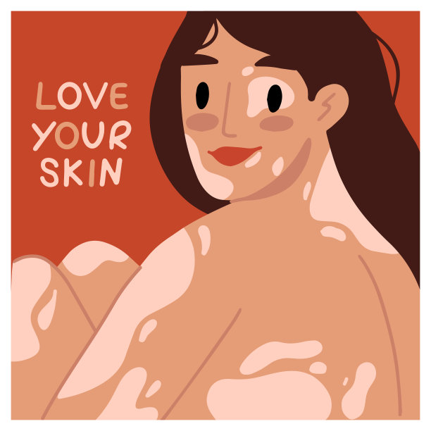 患有白癜风的年轻女性。支持患有慢性皮肤病的人。接受你的身体。美是多样性。自我接纳，自爱的概念。海报，横幅，卡片国际白癜风日图片下载