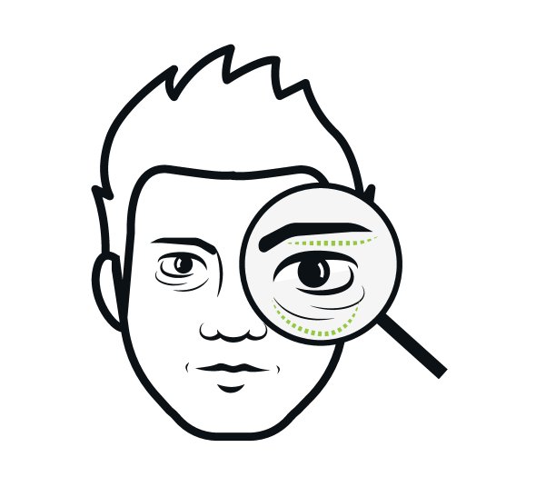 在眼睛附近的皱纹注射肉毒杆菌。上睑减睑、提睑整形的概念。眼部皱纹，面部皱纹，手术疤痕，抗衰老治疗。可编辑的矢量图标在白色背景。图片下载