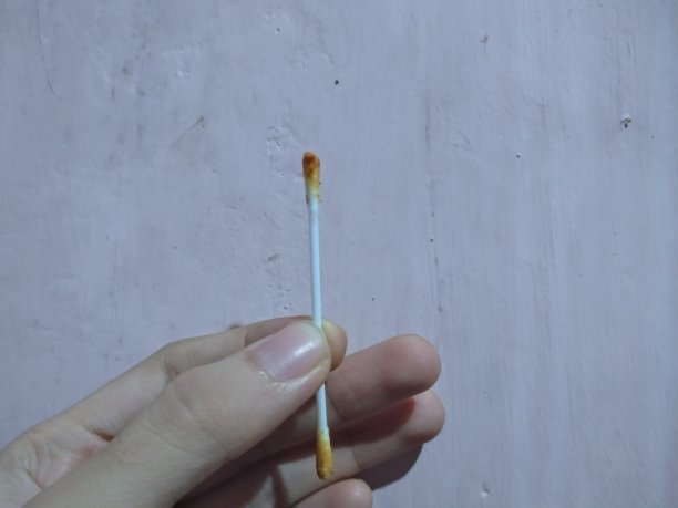 耳道棉签上的黄色分泌物图片下载