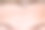 女性在进行返老还嫩手术、注射、治疗、手术前，额头上有皱纹图片下载